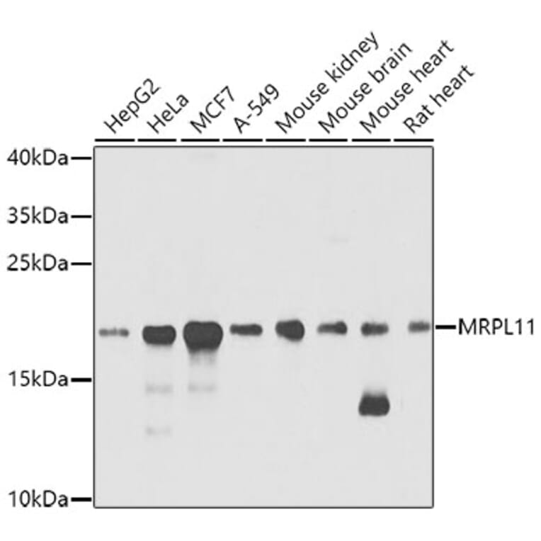 Western Blot - Anti-Mitochondrial ribosomal protein L11 Antibody (A14614) - Antibodies.com