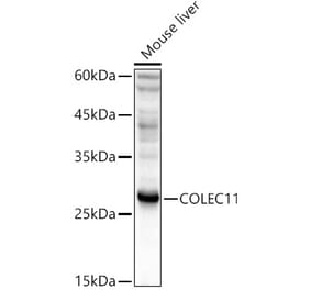 Western Blot - Anti-COLEC11 Antibody (A14615) - Antibodies.com