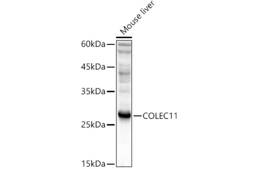 Western Blot - Anti-COLEC11 Antibody (A14615) - Antibodies.com