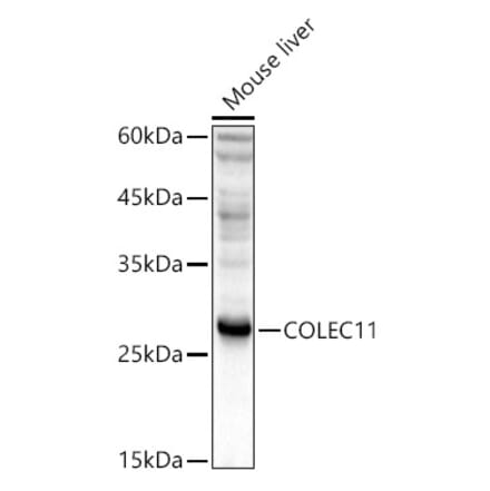 Western Blot - Anti-COLEC11 Antibody (A14615) - Antibodies.com