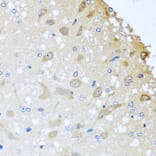 Immunohistochemistry - Anti-COLEC11 Antibody (A14615) - Antibodies.com