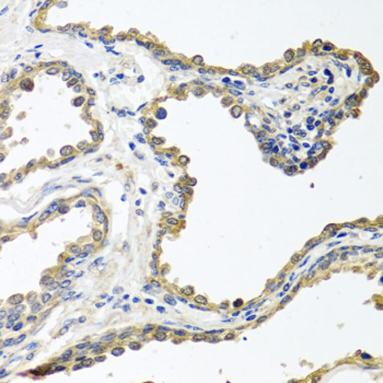 Immunohistochemistry - Anti-COLEC11 Antibody (A14615) - Antibodies.com