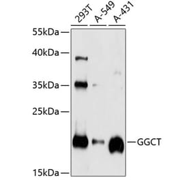 Western Blot - Anti-GGCT Antibody (A14616) - Antibodies.com