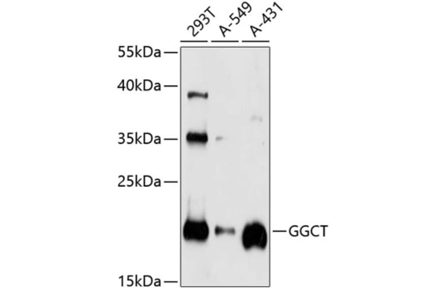 Western Blot - Anti-GGCT Antibody (A14616) - Antibodies.com
