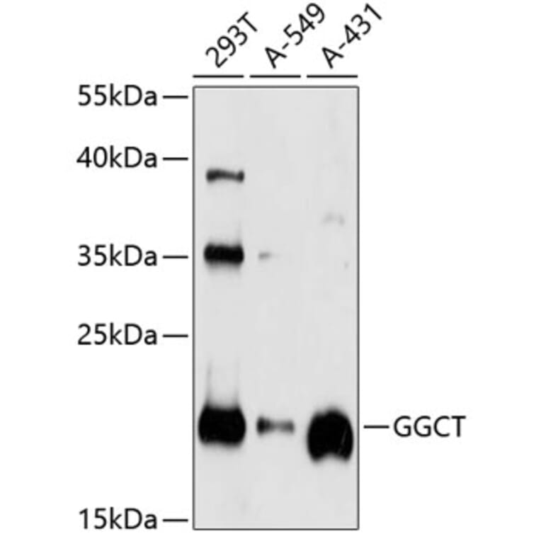 Western Blot - Anti-GGCT Antibody (A14616) - Antibodies.com