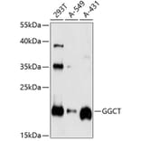 Western Blot - Anti-GGCT Antibody (A14616) - Antibodies.com