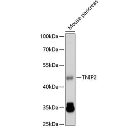 Western Blot - Anti-TNIP2 Antibody (A14617) - Antibodies.com