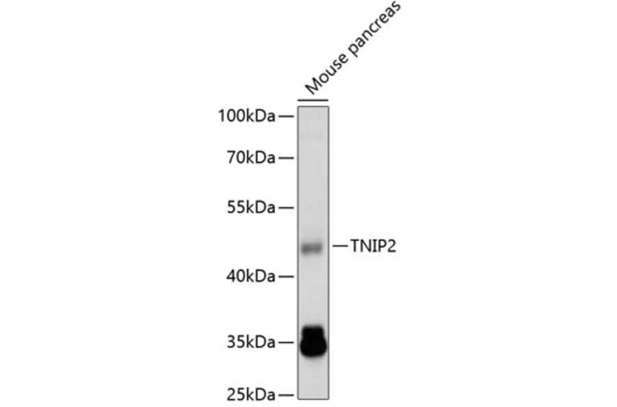 Western Blot - Anti-TNIP2 Antibody (A14617) - Antibodies.com