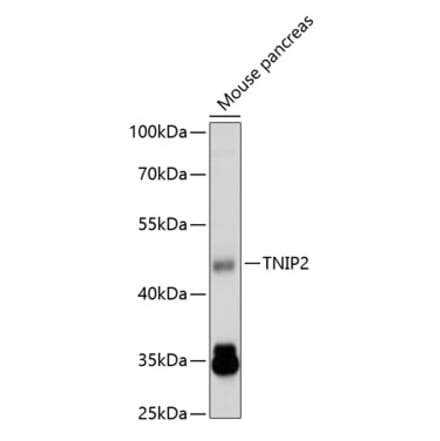 Western Blot - Anti-TNIP2 Antibody (A14617) - Antibodies.com