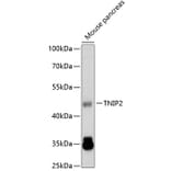 Western Blot - Anti-TNIP2 Antibody (A14617) - Antibodies.com