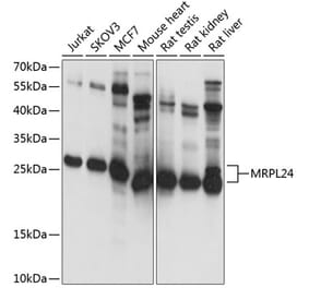 Western Blot - Anti-MRPL24 Antibody (A14618) - Antibodies.com