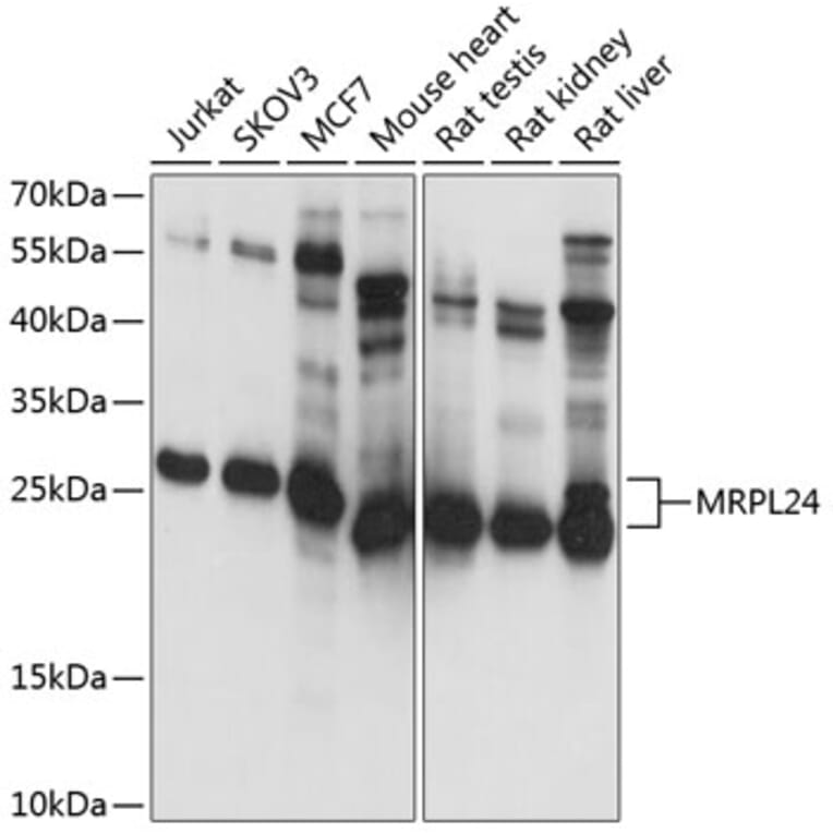 Western Blot - Anti-MRPL24 Antibody (A14618) - Antibodies.com