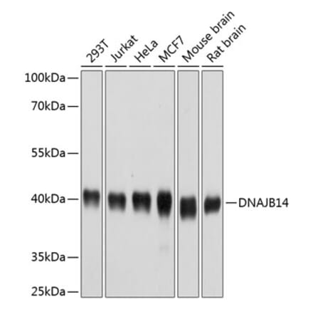 Western Blot - Anti-DNAJB14 Antibody (A14619) - Antibodies.com