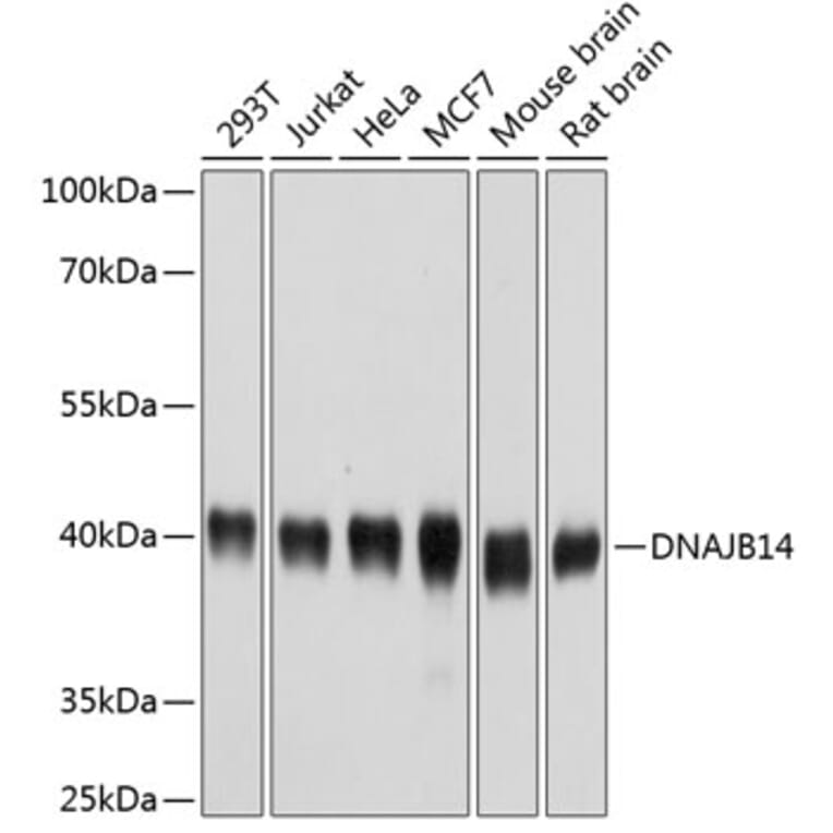 Western Blot - Anti-DNAJB14 Antibody (A14619) - Antibodies.com