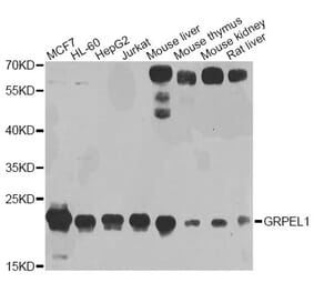 Western Blot - Anti-GRPEL1 Antibody (A4999) - Antibodies.com