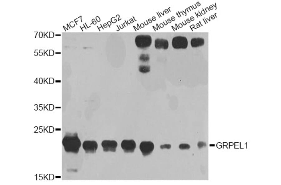 Western Blot - Anti-GRPEL1 Antibody (A4999) - Antibodies.com