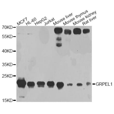 Western Blot - Anti-GRPEL1 Antibody (A4999) - Antibodies.com