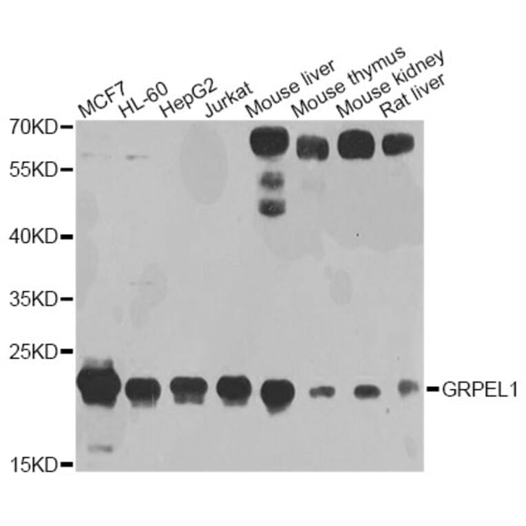 Western Blot - Anti-GRPEL1 Antibody (A4999) - Antibodies.com