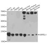 Western Blot - Anti-GRPEL1 Antibody (A4999) - Antibodies.com