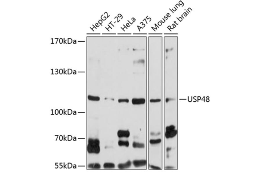 Western Blot - Anti-USP48 Antibody (A14621) - Antibodies.com