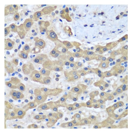 Immunohistochemistry - Anti-GFM1 Antibody (A14622) - Antibodies.com