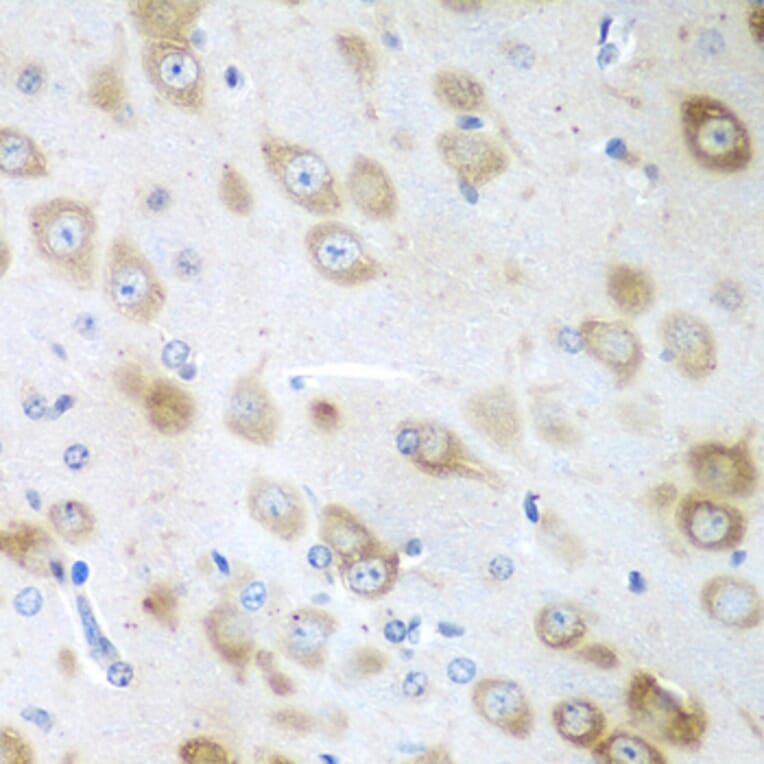 Immunohistochemistry - Anti-GFM1 Antibody (A14622) - Antibodies.com