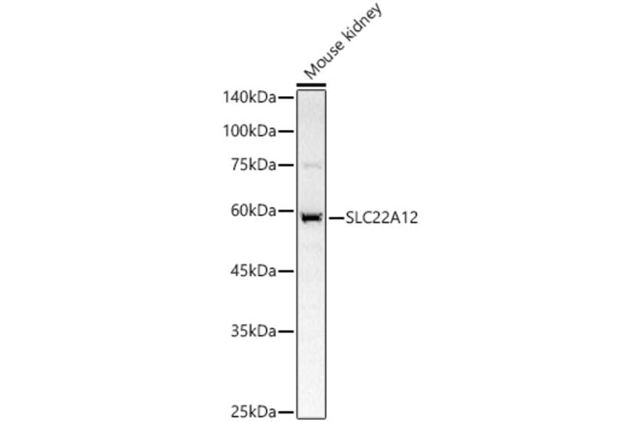 Western Blot - Anti-RST Antibody (A14623) - Antibodies.com
