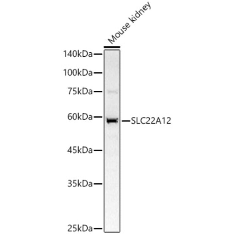 Western Blot - Anti-RST Antibody (A14623) - Antibodies.com