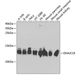 Western Blot - Anti-DNAJC19 Antibody (A14624) - Antibodies.com