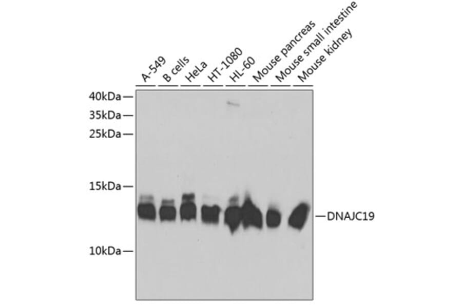Western Blot - Anti-DNAJC19 Antibody (A14624) - Antibodies.com