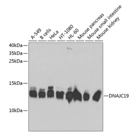 Western Blot - Anti-DNAJC19 Antibody (A14624) - Antibodies.com