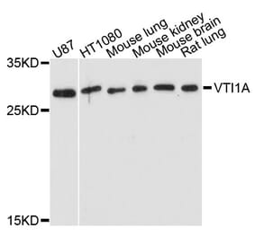 Western Blot - Anti-VTI1A Antibody (A5162) - Antibodies.com