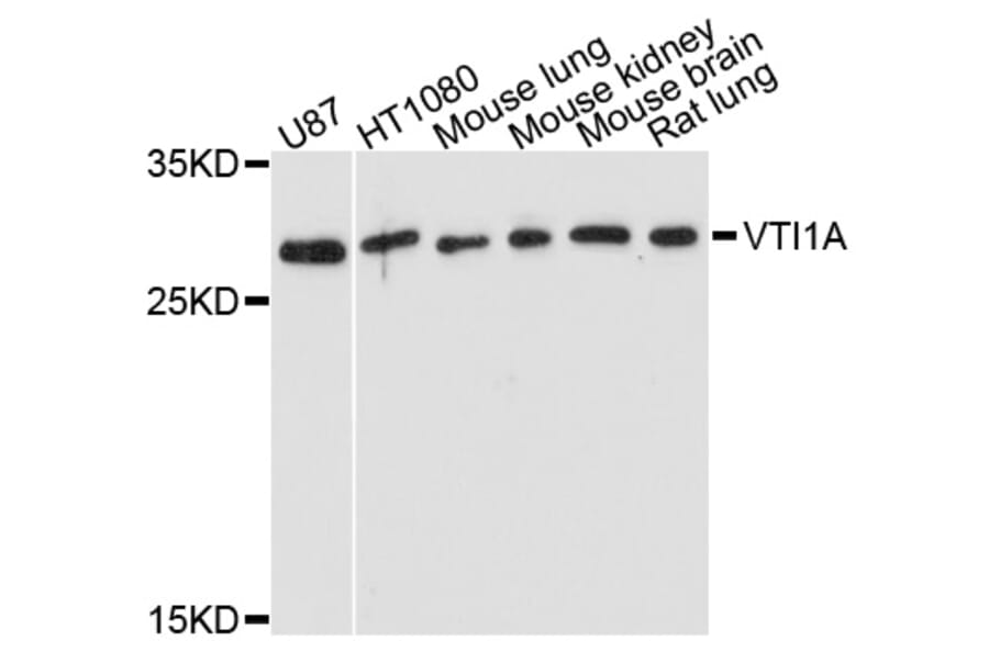 Western Blot - Anti-VTI1A Antibody (A5162) - Antibodies.com