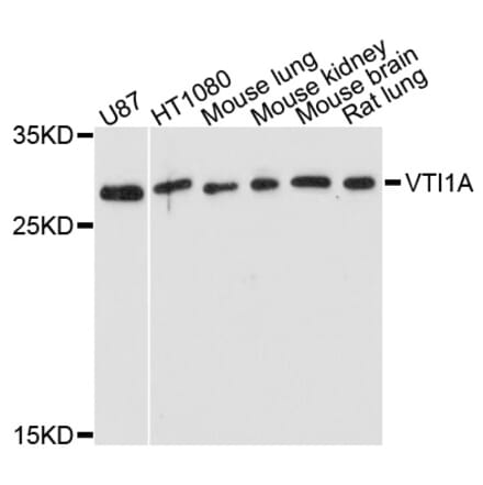 Western Blot - Anti-VTI1A Antibody (A5162) - Antibodies.com