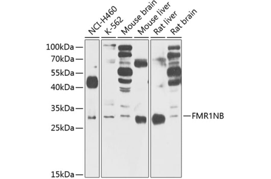 Western Blot - Anti-FMR1NB Antibody (A14628) - Antibodies.com