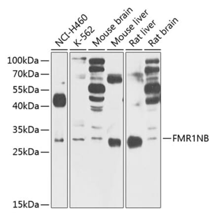Western Blot - Anti-FMR1NB Antibody (A14628) - Antibodies.com