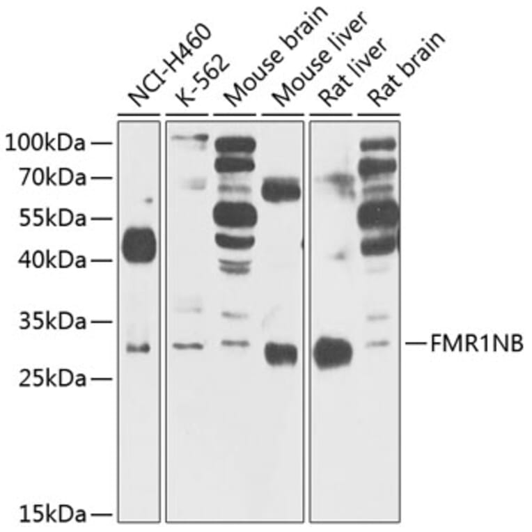 Western Blot - Anti-FMR1NB Antibody (A14628) - Antibodies.com