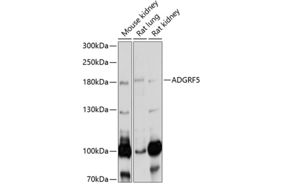 Western Blot - Anti-GPCR GPR116 Antibody (A14629) - Antibodies.com