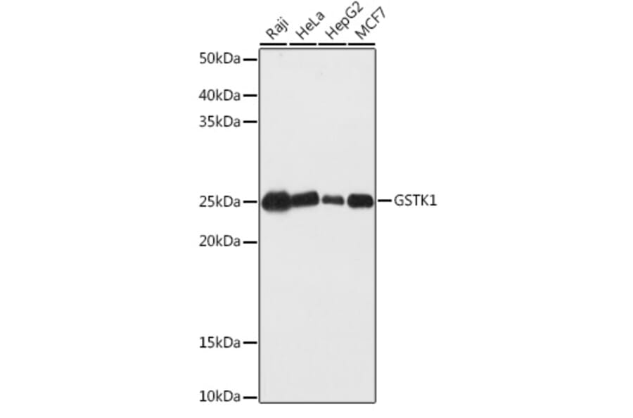 Western Blot - Anti-GSTK1 Antibody (A14631) - Antibodies.com
