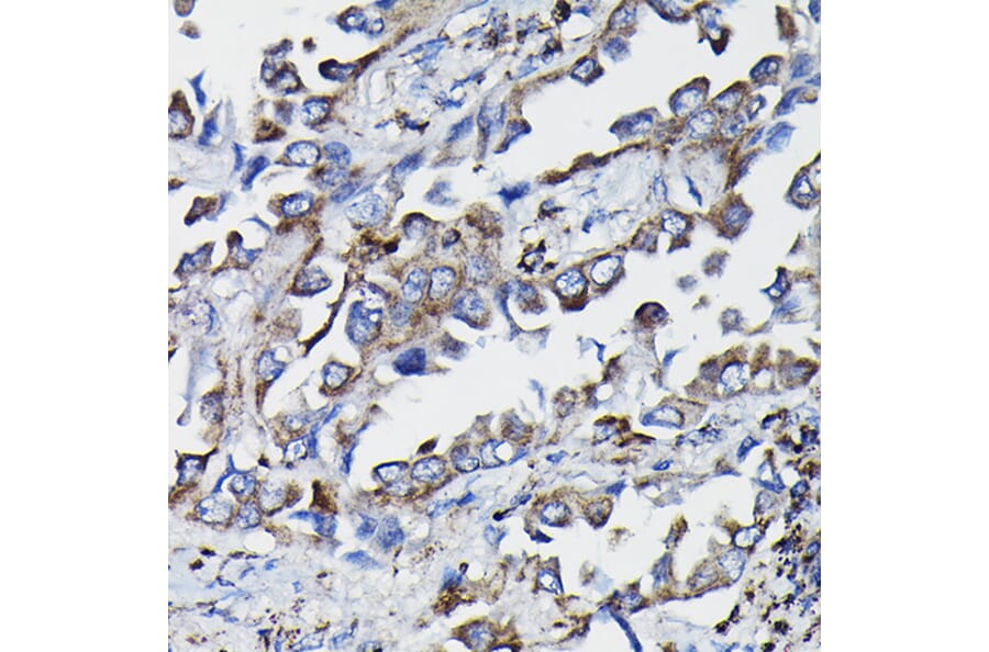 Immunohistochemistry - Anti-GSTK1 Antibody (A14631) - Antibodies.com