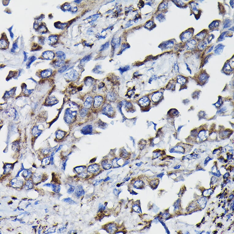 Immunohistochemistry - Anti-GSTK1 Antibody (A14631) - Antibodies.com