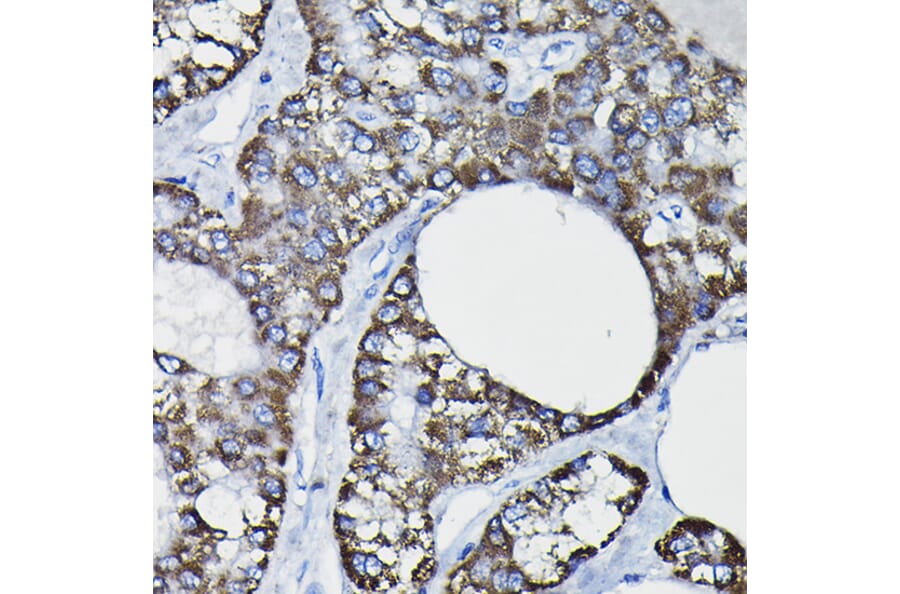 Immunohistochemistry - Anti-GSTK1 Antibody (A14631) - Antibodies.com