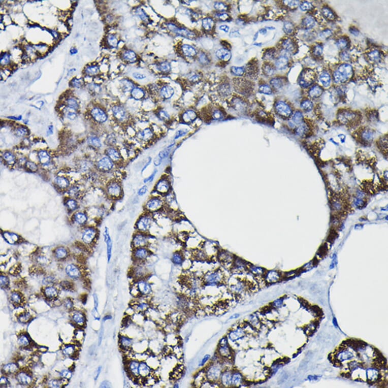 Immunohistochemistry - Anti-GSTK1 Antibody (A14631) - Antibodies.com