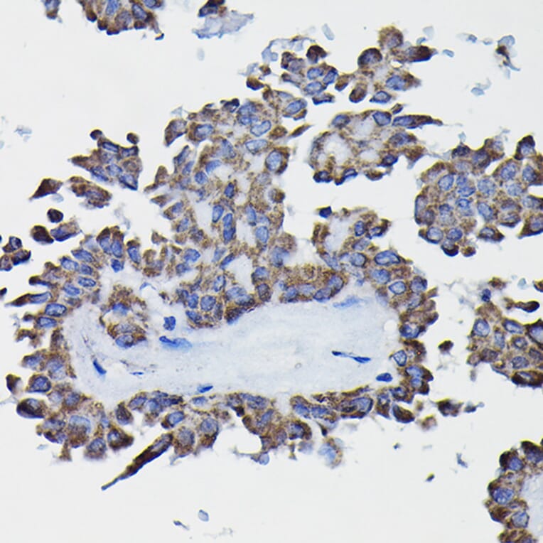 Immunohistochemistry - Anti-GSTK1 Antibody (A14631) - Antibodies.com