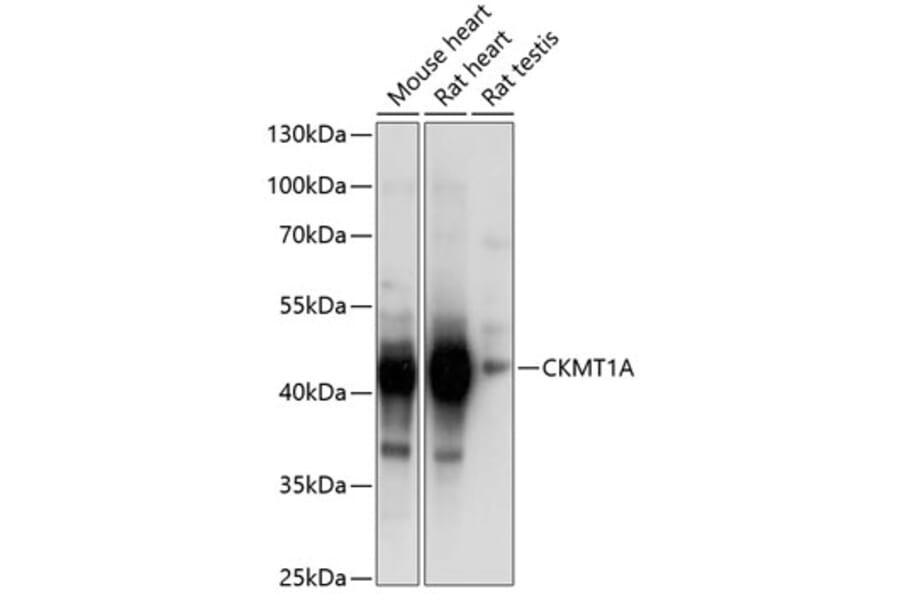 Western Blot - Anti-CKMT1A Antibody (A14632) - Antibodies.com