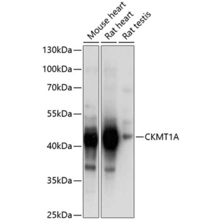 Western Blot - Anti-CKMT1A Antibody (A14632) - Antibodies.com