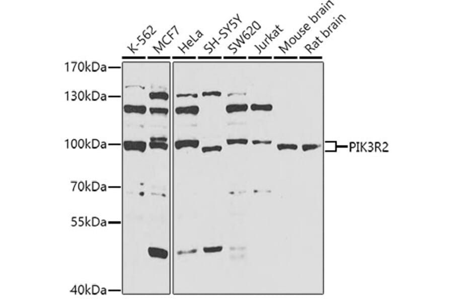 Western Blot - Anti-PIK3R2 Antibody (A5241) - Antibodies.com