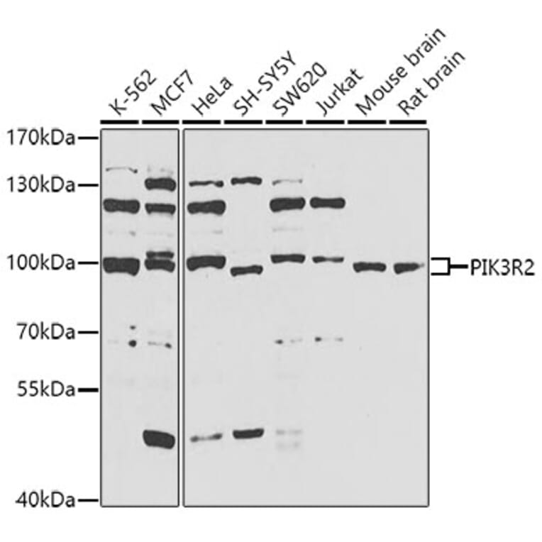 Western Blot - Anti-PIK3R2 Antibody (A5241) - Antibodies.com