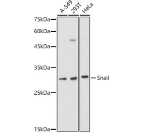 Western Blot - Anti-SNAIL Antibody (A14634) - Antibodies.com