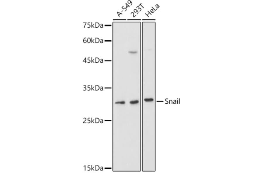 Western Blot - Anti-SNAIL Antibody (A14634) - Antibodies.com